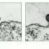 Micrograph showing HIV fusing with a cell membrane on entry. Ã‚Â© 2002 by Bruce Alberts et al.